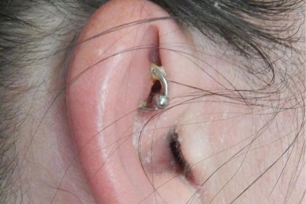 Tại sao lỗ xỏ khuyên bị đào thải