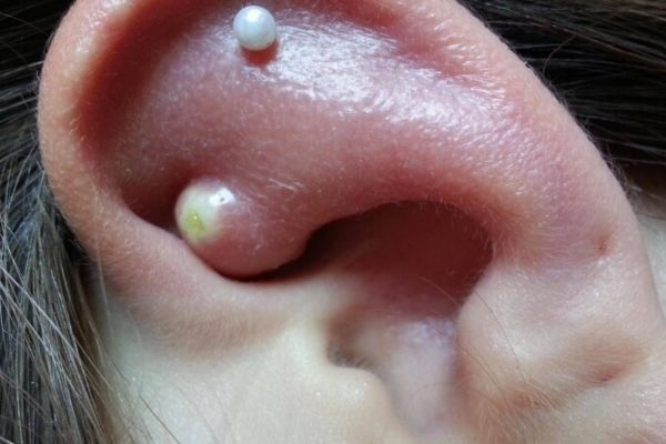 Tại sao lỗ xỏ khuyên bị đào thải