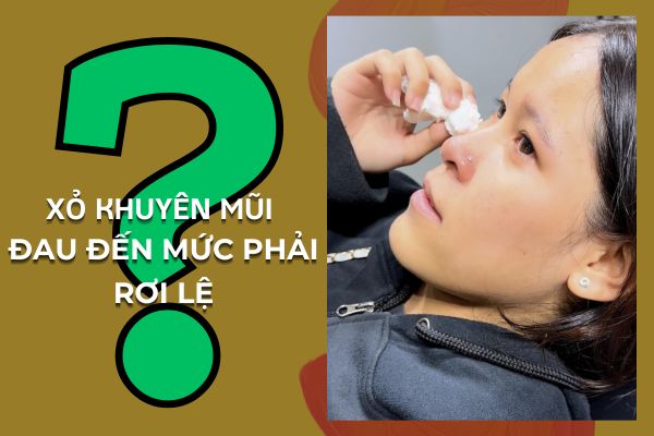 Tại sao xỏ khuyên mũi bị chảy nước mắt?