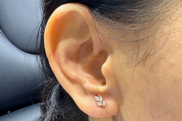 Tại sao xỏ lâu nhưng lỗ xỏ vẫn chưa lành?