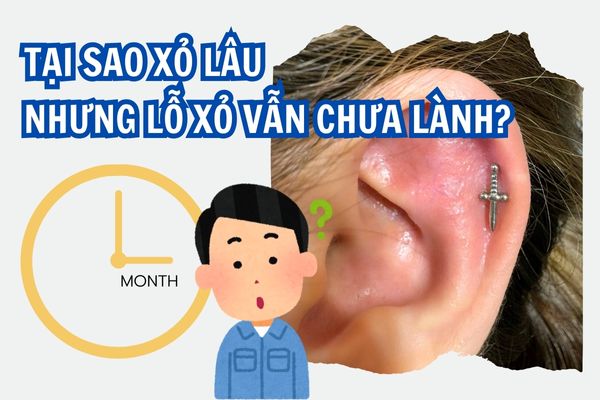 Tại sao xỏ lâu nhưng lỗ xỏ vẫn chưa lành?