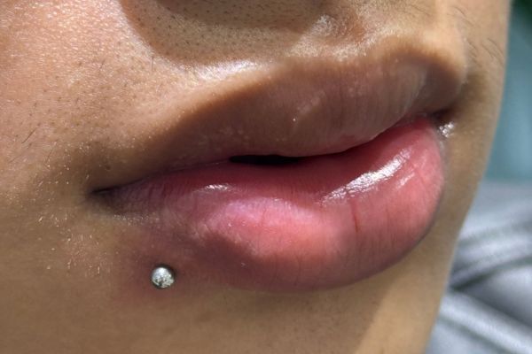 Tháo khuyên môi bao lâu thì tịt?