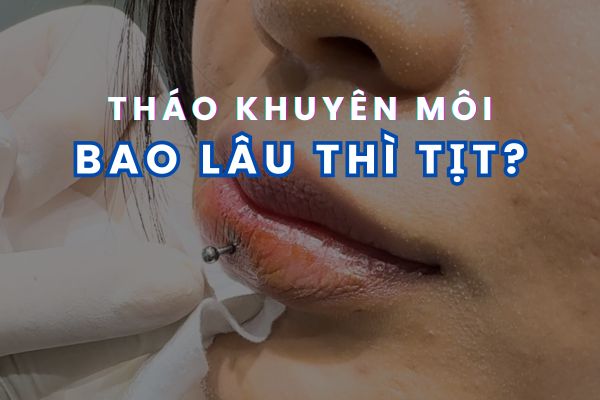 Tháo khuyên môi bao lâu thì tịt?
