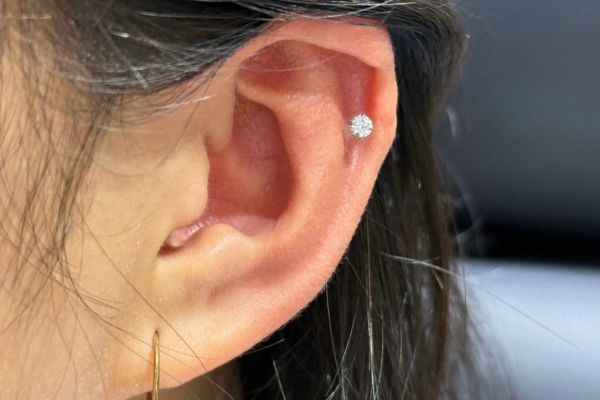 Thay khuyên sớm có sao không? Khi nào cần thay khuyên sớm?