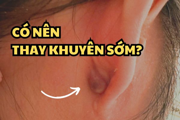 Thay khuyên sớm có sao không? Khi nào cần thay khuyên sớm?