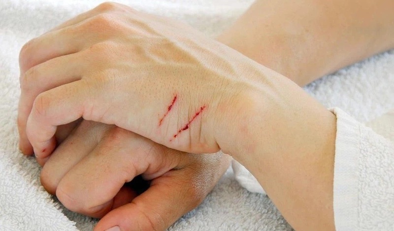 Thịt độc có nên xỏ khuyên?