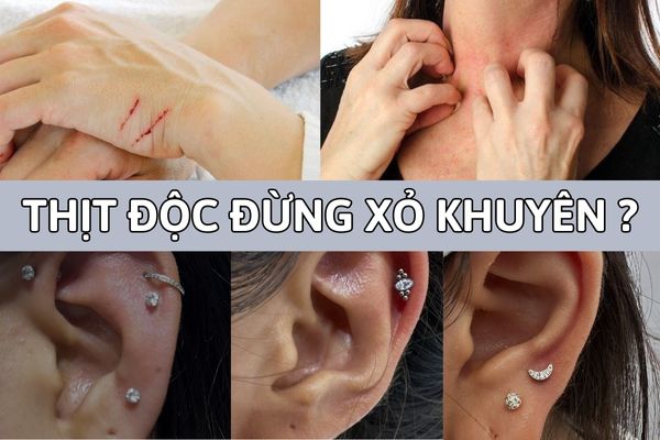 Thịt độc có nên xỏ khuyên?