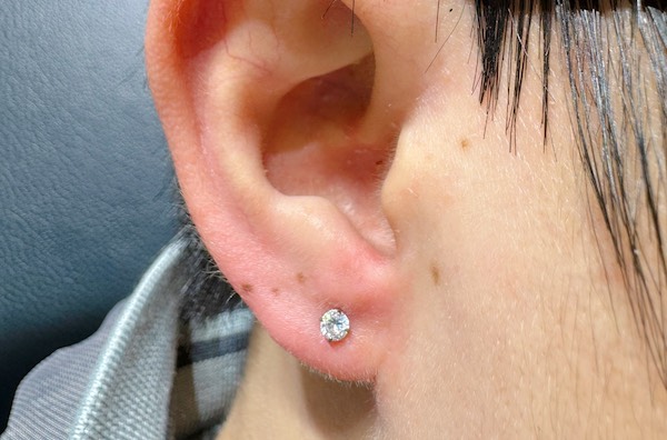 Thịt tai nhỏ xỏ khuyên được không