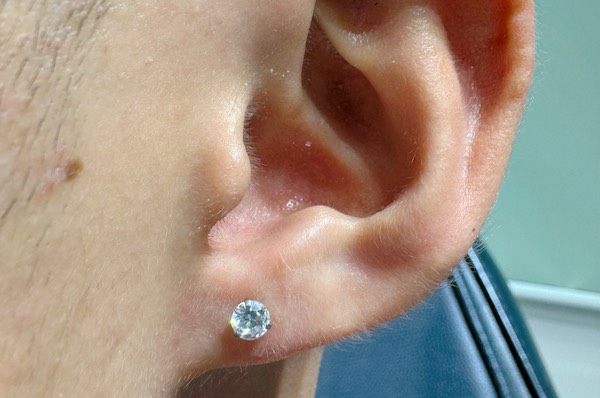 Thịt tai nhỏ xỏ khuyên được không