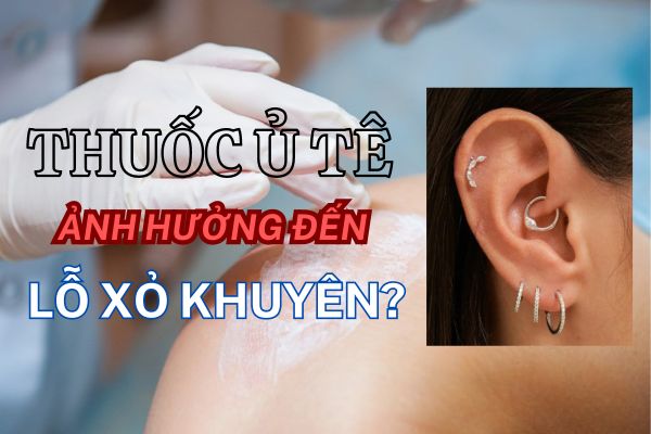 Thuốc ủ tê ảnh hưởng đến lỗ xỏ khuyên không?