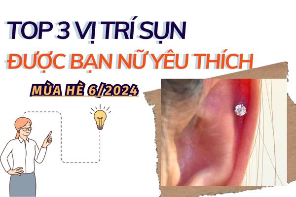 Top 3 vị trí sụn được bạn nữ yêu thích nhất mùa hè 6/2024