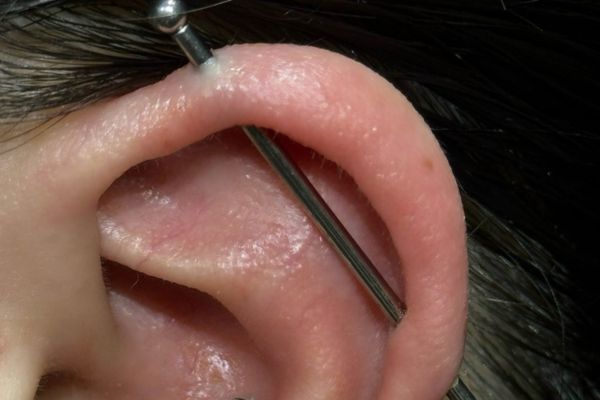 Top 5 vị trí sụn hot được bạn nữ lựa chọn