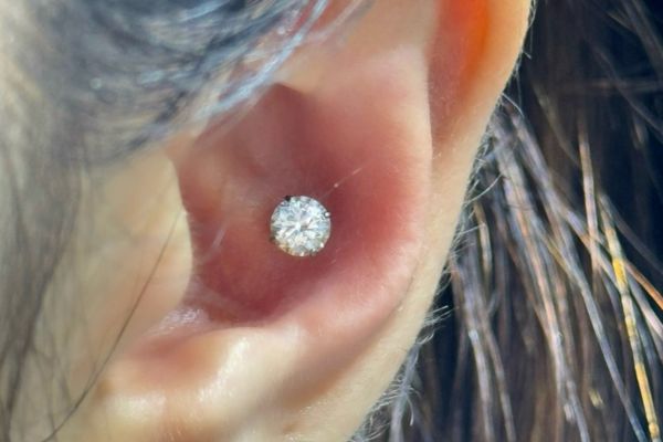 Top 5 vị trí sụn hot được bạn nữ lựa chọn