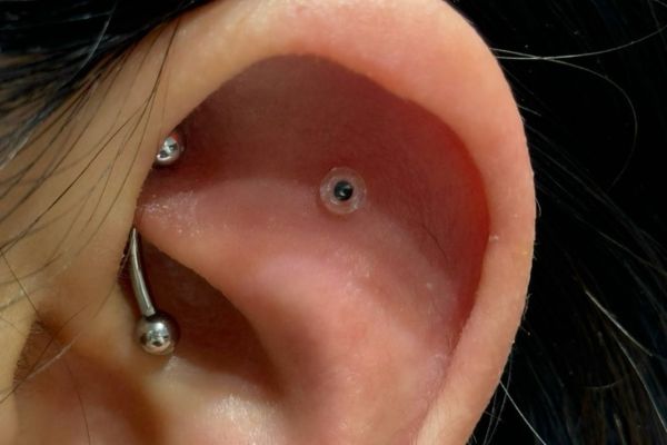 Top 5 vị trí sụn hot được bạn nữ lựa chọn