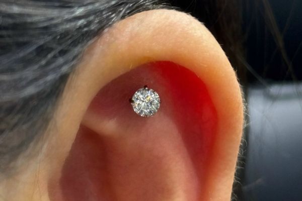 Top 5 vị trí sụn hot được bạn nữ lựa chọn