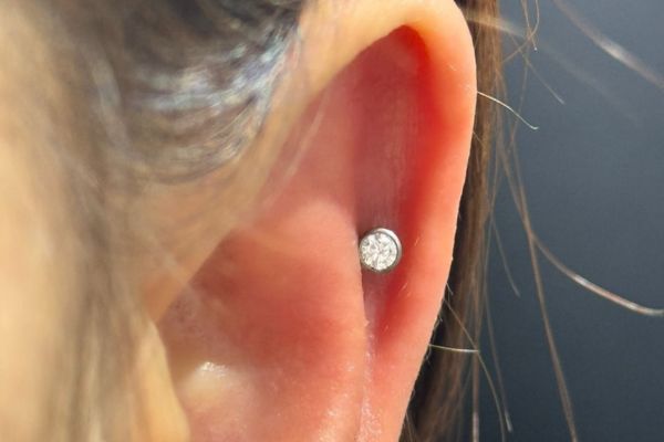 Top 5 vị trí sụn hot được bạn nữ lựa chọn