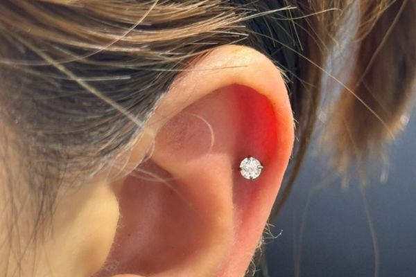 Top 5 vị trí sụn hot được bạn nữ lựa chọn