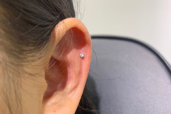 Top 5 vị trí sụn hot được bạn nữ lựa chọn