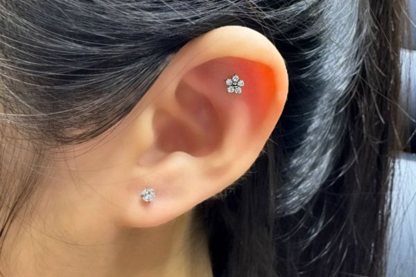 Top 5 vị trí sụn hot được bạn nữ lựa chọn