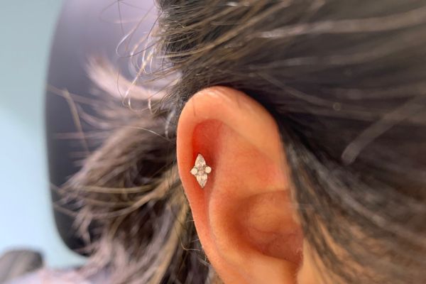 Top 5 vị trí sụn hot được bạn nữ lựa chọn