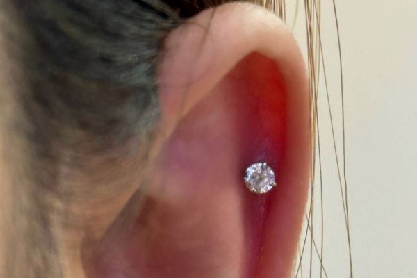 Top 5 vị trí sụn hot được bạn nữ lựa chọn