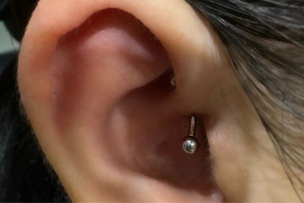 Top 5 vị trí sụn hot được bạn nữ lựa chọn