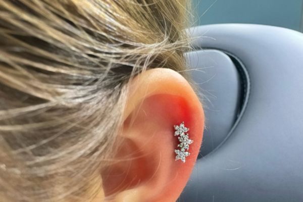 Top 5 vị trí sụn hot được bạn nữ lựa chọn