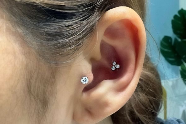 Top 5 vị trí sụn hot được bạn nữ lựa chọn