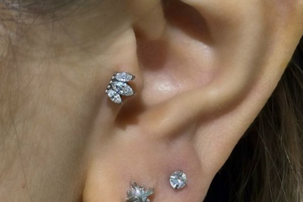 Top 5 vị trí sụn hot được bạn nữ lựa chọn