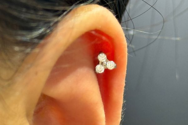 Top 5 vị trí sụn hot được bạn nữ lựa chọn