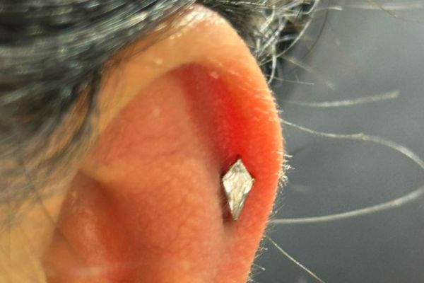 Top 5 vị trí sụn hot được bạn nữ lựa chọn