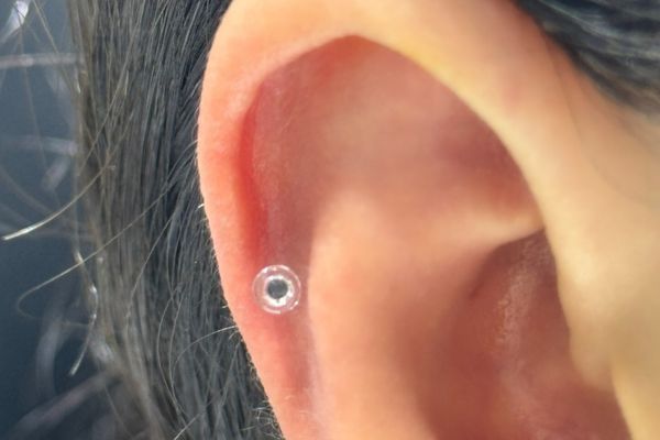 Top 5 vị trí sụn hot được bạn nữ lựa chọn