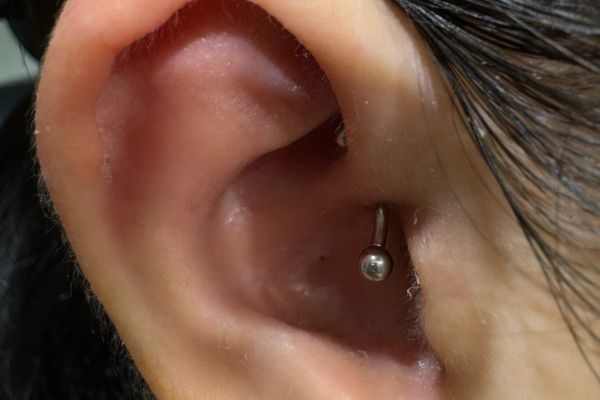 Top 3 vị trí sụn được bạn nữ yêu thích nhất mùa hè 6/2024