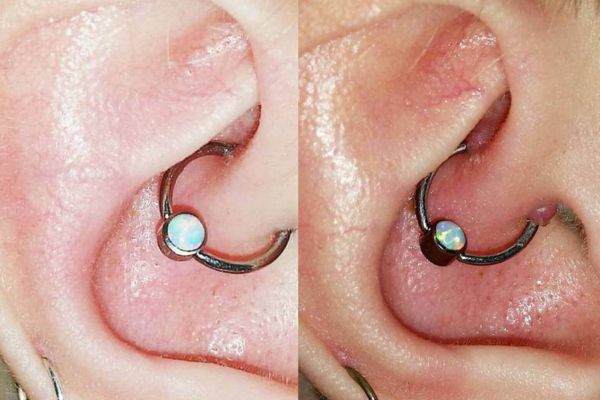 Vaseline tác dụng gì và có nên dùng bôi lỗ xỏ không?