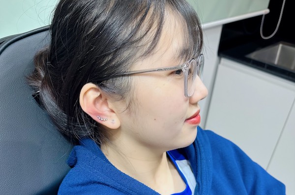 Vệ sinh lỗ tai sau khi bấm có thực sự quan trọng?