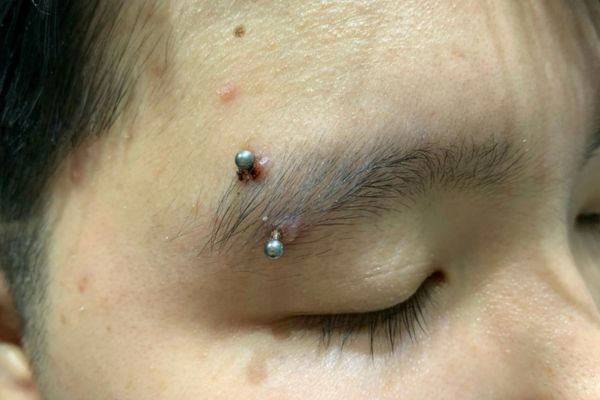 Vệ sinh lỗ xỏ khuyên đến khi nào?