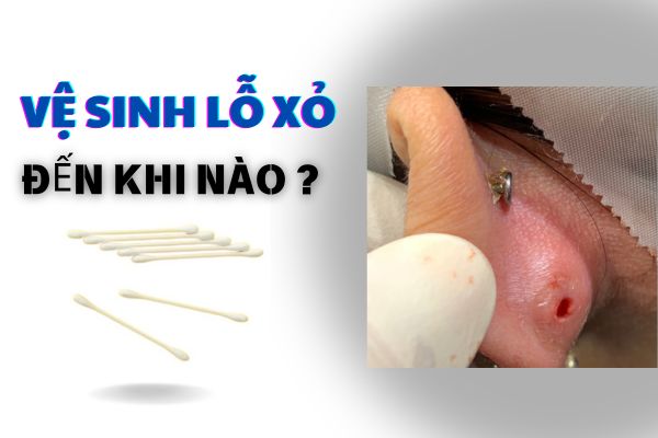 Vệ sinh lỗ xỏ khuyên đến khi nào?