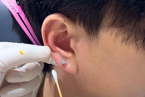 Vệ sinh lỗ xỏ khuyên tai bằng gì?