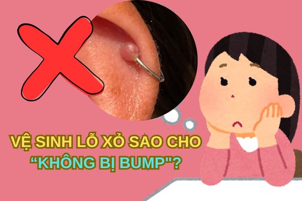 Vệ sinh lỗ xỏ sụn sao cho an toàn, không bị bump?