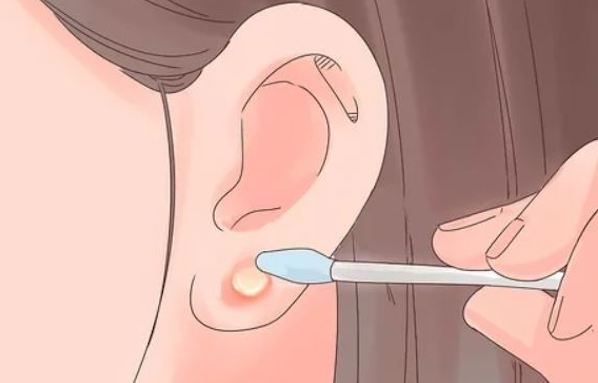 vệ sinh sau khi bấm lỗ tai