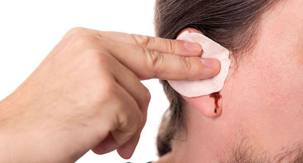 Vệ sinh thấy lỗ xỏ khuyên ra máu phải làm sao?