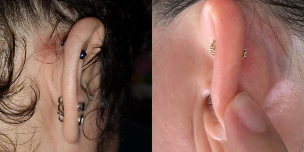 6 lí do thường gặp làm bạn bị bump lỗ xỏ