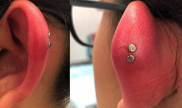 6 lí do thường gặp làm bạn bị bump lỗ xỏ