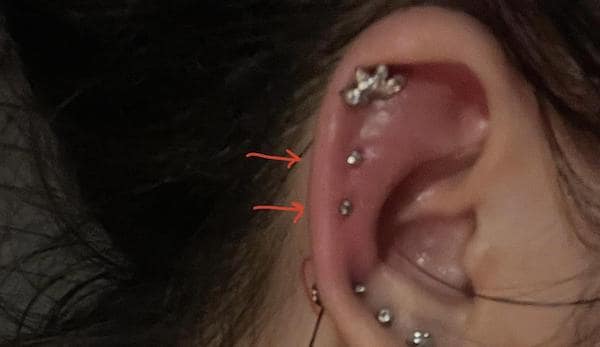 6 lí do thường gặp làm bạn bị bump lỗ xỏ