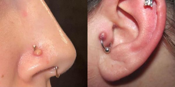 6 lí do thường gặp làm bạn bị bump lỗ xỏ