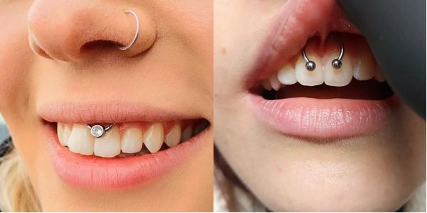 vị trí xỏ khuyên có thể giấu - xỏ khuyên smiley