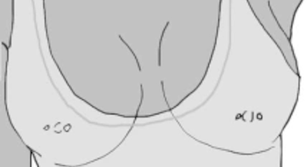 các vị trí xỏ khuyên có thể giấu kín đáo - xỏ núm