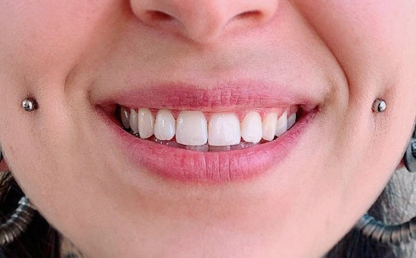 vị trí xỏ khuyên độc lạ - xỏ khuyên má lúm