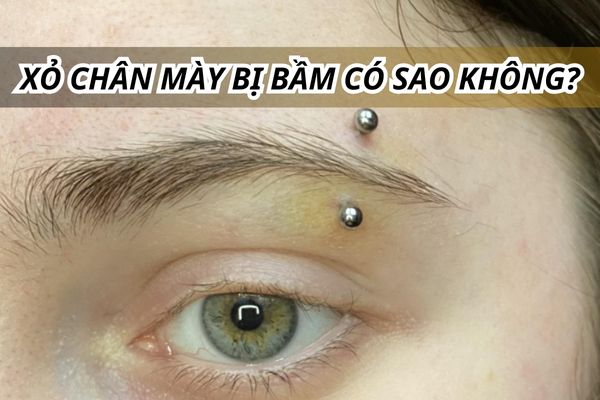 Xỏ chân mày bị bầm tím có sao không? Cách xử lý tại nhà an toàn