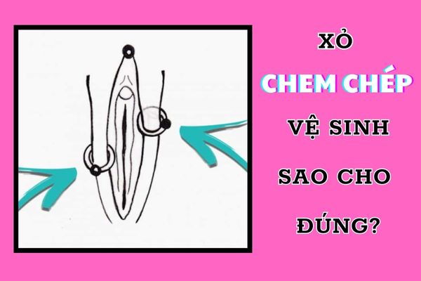Xỏ chem chép vệ sinh như thế nào